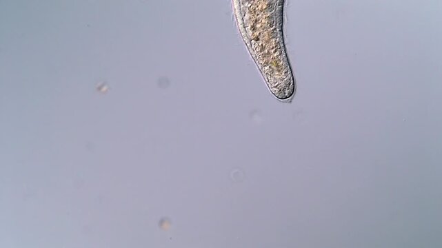 High resolution microscopy of Stenostomum flatworm in freshwater