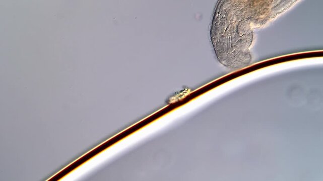 Stenostomum flatworm under microscope with protozoa activity