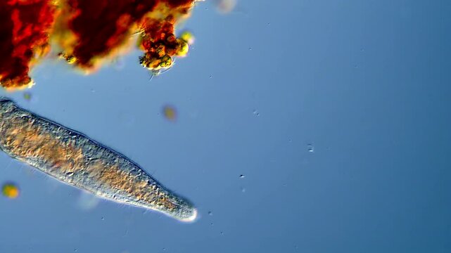 Microscopy of Stenostomum freshwater flatworms in motion