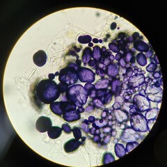 Microscopic view of potato cells showing purple-stained starch granules (amyloplasts) after iodine treatment, highlighted under magnification.