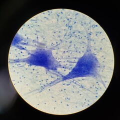 Microscopic image of human nerve cells showing neuron bodies and dendrites stained blue for structural visibility in a lab slide.
