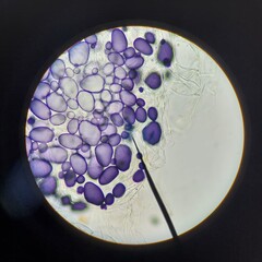 Microscopic view of potato cells showing purple-stained starch granules (amyloplasts) after iodine treatment, highlighted under magnification.