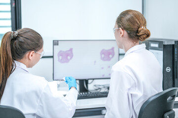 Two medical researchers analyze microscope images of tissue samples on a computer. The team is collaborating on a diagnosis for a cancer research project in the hospital lab.