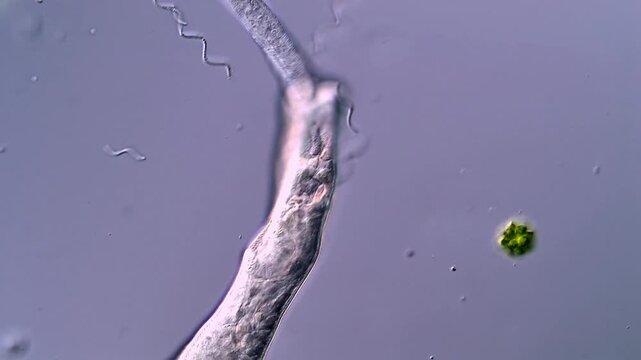 Fascinating Live Cercariae of Fluke Parasites in 4K