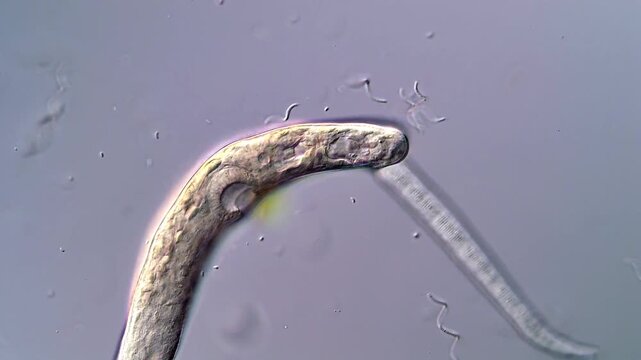 4K Ultra HD Video of Parasite Larvae Motion