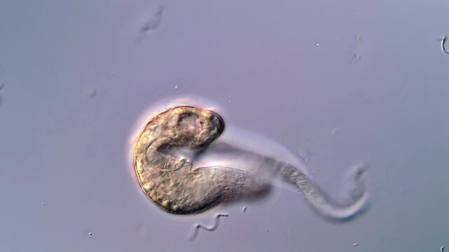 Trematodes Larvae Under 4K High-Resolution Microscope
