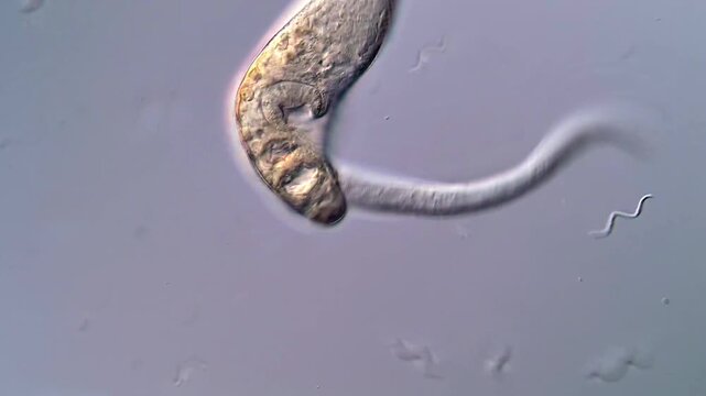 4K Footage of Schistosoma Larvae Swimming Freely