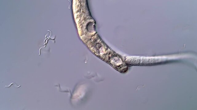 4K High-Magnification Video of Parasite Larvae