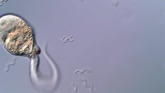 Live Cercariae Larvae of Fluke Parasites in 4K