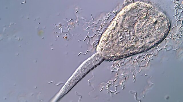 Swimming Parasite Larvae in 4K Microscope Detail, sample from the snails
