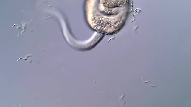 4K Footage of Trematodes Larvae in Water