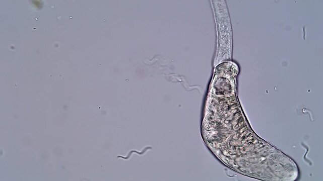 Close-Up 4K Video of Trematodes Larvae Swimming