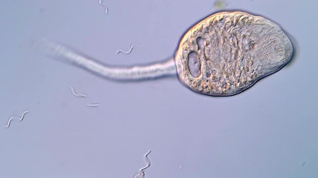 4K Ultra HD Footage of Parasite Larvae in Action