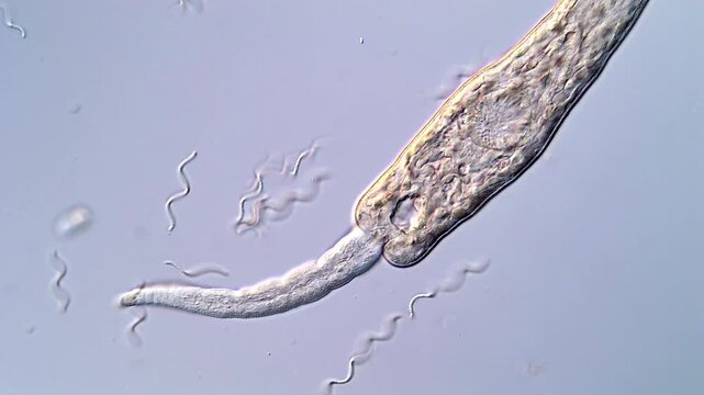 Fascinating 4K Video of Schistosoma Larvae Movement