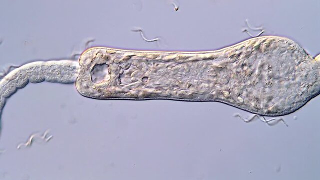 4K High-Magnification Video of Cercariae Larvae
