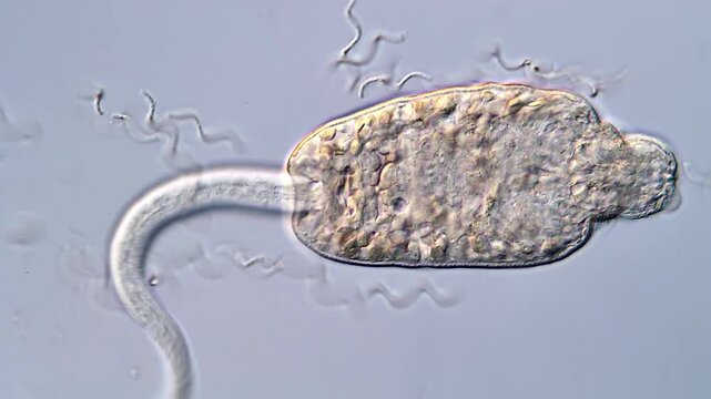4K Close-Up Microscope View of Trematodes Larvae