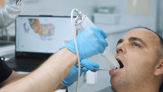 A dentist scans a male patient's jaw with a modern dental scanner. Modern dental clinic. New technologies in dental prosthetics.