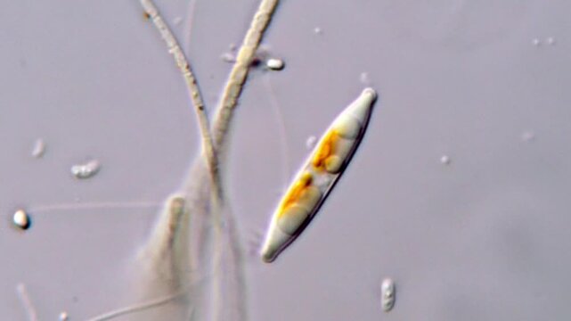 Moving diatom microorganisms in laboratory footage