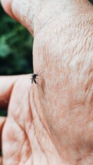 mosquito spreads the dengue virus through its bite into the skin, Mosquitoes bite the skin