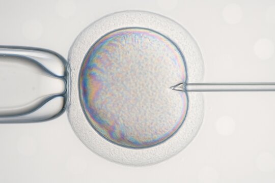 Clinical micrograph of an ICSI fertility procedure showing cell injection.