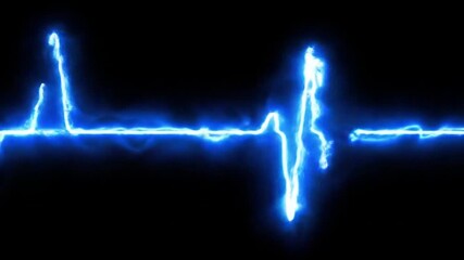 Ideal for medical presentations, educational materials, healthcare articles, and cardiologyrelated designs. Captivating blue ecg rhythm line symbolizing heart health on dark backdrop. - Powered by Adobe