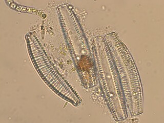 Brightfield micrograph of Cymbella diatom at 500x magnification