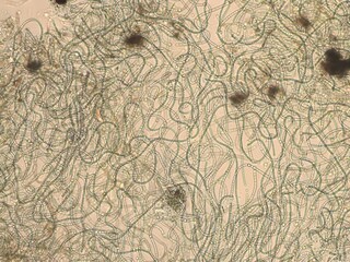 Brightfield micrograph of Nostoc commune cyanobacteria at 100x magnification