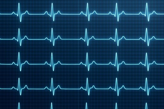 Blue glowing ECG heart rate lines on dark grid background showing repeating pulse waveforms in a creative digital style concept of health monitoring. Ai generative