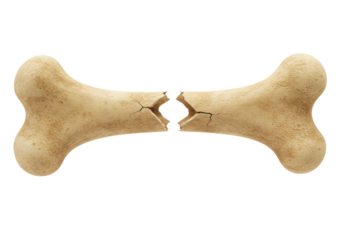 Isolated broken bone illustration of a fractured skeletal object of a mammal or dinosaur