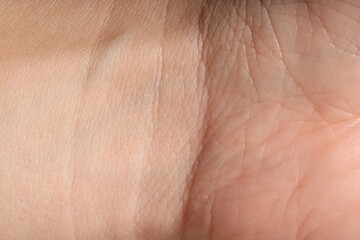 Fototapeta premium Human skin, closeup view. Detailed texture of surface