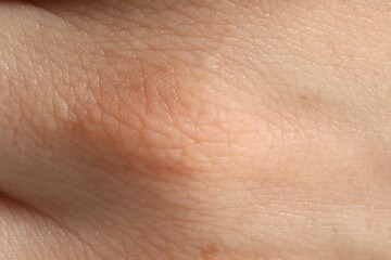 Human skin, closeup view. Detailed texture of surface