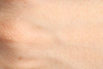 Human skin, closeup view. Detailed texture of surface