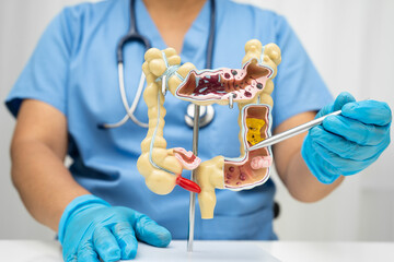 Intestine, Asian woman holding human anatomy model.