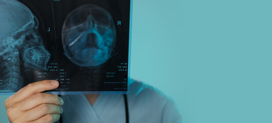 Mortality in Medicine Concept – Doctor Holding Skull X-ray