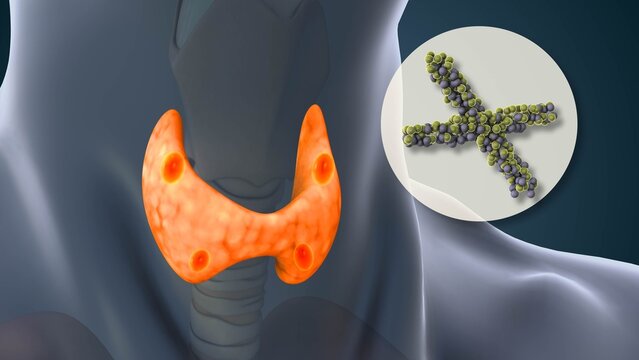Human Parathyroid Gland Tumor Cells Medical Concept