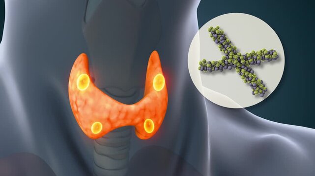 Human Parathyroid Gland Tumor Cells Medical Concept
