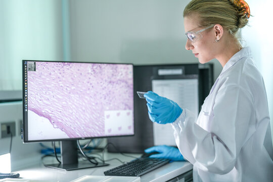 A medical researcher analyzes microscope images of tissue samples on a computer. She is comparing a slide to the digital image for a cancer research project in her lab.