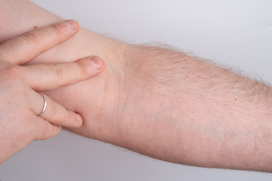 Back and arm pain are usually caused by muscle injury. The concept of medicine and first aid
