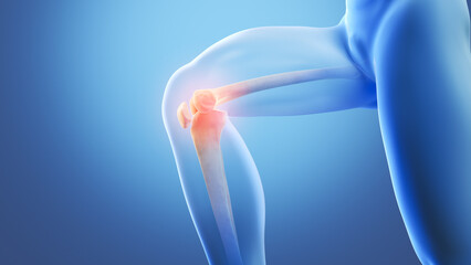 X-ray image of a blue human knee with painful spots highlighted in red, 3d illustration.