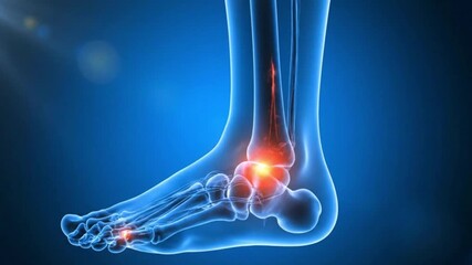 An anatomical illustration of human foot and ankle pain showing joint inflammation injury or arthritis a medical concept for orthopedic rheumatology or podiatry diagnosis of a sprain