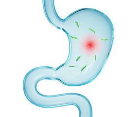 Stomach with Helicobacter Pylori Bacteria 3d Illustration