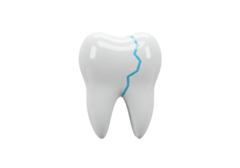 Isolated chipped tooth model showing a crack in the enamel, dental healthcare symbol