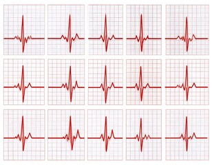 Cardiogram Rhythms Collection for Medical Illustrations