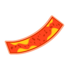 Illustration of Cholesterol in Blood