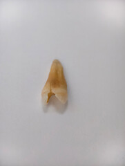 Pulled out cracked and damaged tooth, second premolar on white background