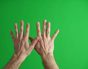 Two hands raised against a green background
