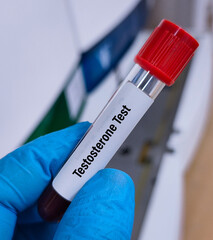 Blood sample for Testosterone test. Heathcare or medical concept. Sex hormone.