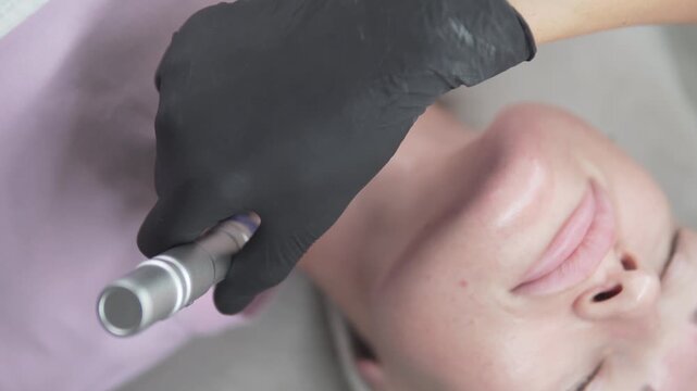 Close-up of a cosmetologist performing microneedling facial treatment on a woman is skin using a professional dermapen device.