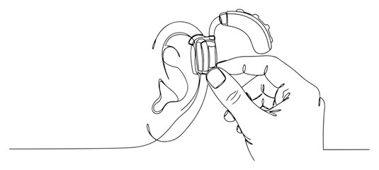 Fitting a Hearing Aid on the Ear