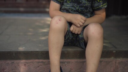 the child touches his scraped knee with a finger while sitting on the porch on a hot summer day he is wearing a t shirt and shorts